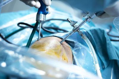 Cropped hands of doctor performing operation on patient knee in hospital