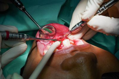 Cropped hands of doctors performing surgery on patient in hospital