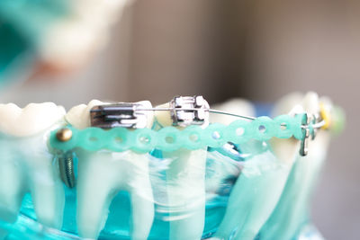 Close-up of artificial teeth