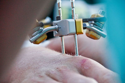 Cropped image of surgeon operating hand on table