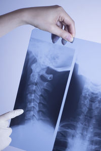 Cropped hands of woman holding x-ray image against wall