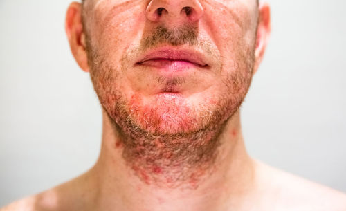 Midsection of man with beard infection against gray background