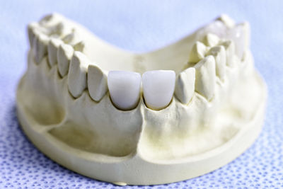 Close-up of dentures on table