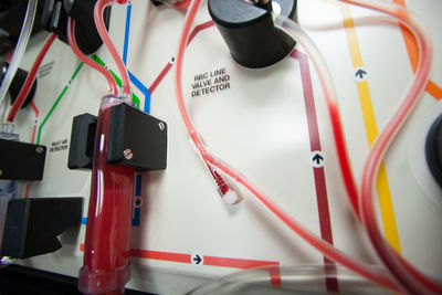 Close-up of apheresis machine in hospital