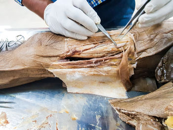 Cropped hands of doctor doing surgery in hospital