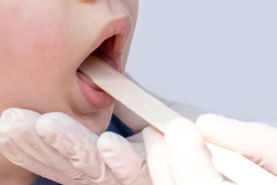 Doctor checking kid throat with wooden spatula.child sore throat treatment