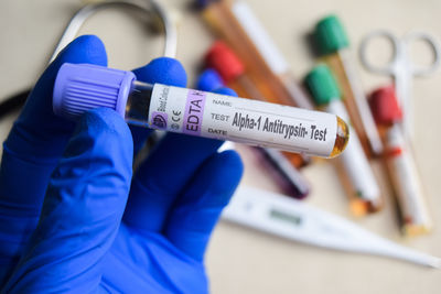 Cropped hand of doctor holding thermometer