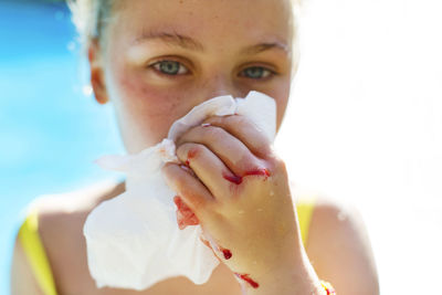 Portrait of girl covering her bleeding nose