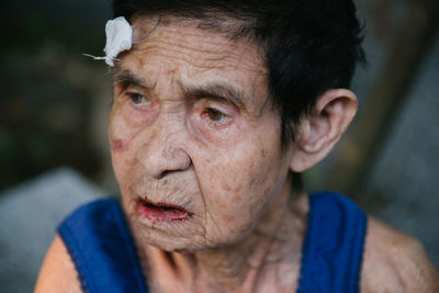 Woman with injured forehead outdoors