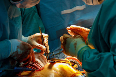 Group of people in hands