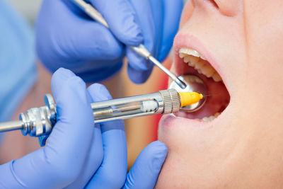 Close-up of dentist examining patient teeth