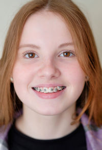 Beautiful caucasian young girl in dental braces smiles. teenage concept.