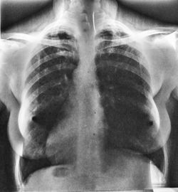 Woman chest skeleton