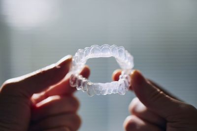 Close-up of hands holding dental aligner