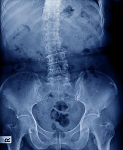 Full frame shot of x-ray