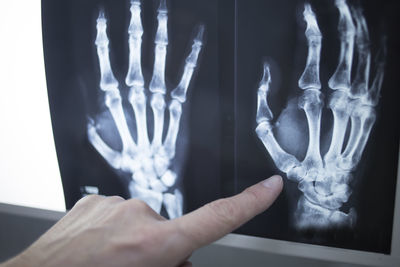 Cropped hand of doctor showing x-ray image in hospital