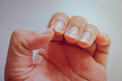 Cropped hand with broken fingernail against white background