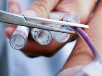 Close-up of doctor cutting pipe attached in test tube