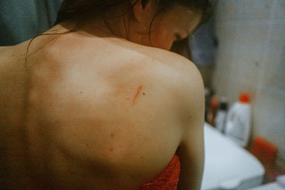 Rear view of woman with physical injury