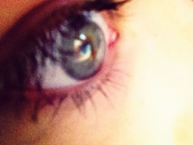 My eye looks creepyy