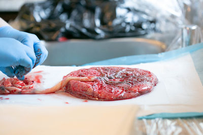 Gloved hands with placenta on white pad attached to umiblical cord.