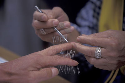 Cropped image of person getting acupuncture treatment