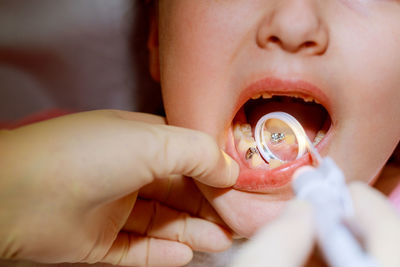 Cropped hands of dentist examining girl mouth