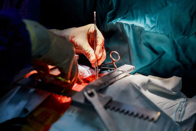 Cropped hands of doctor doing surgery of patient