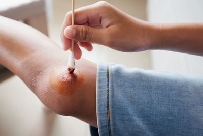 Asian child girl cleaning her wound on her knee injury and perform first aid by herself 