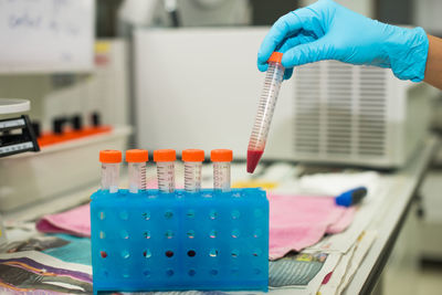 Cropped hands of scientist experimenting in laboratory