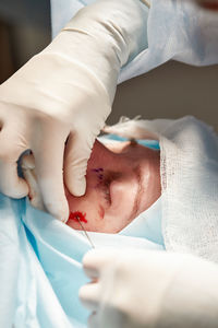 Midsection of doctor examining patient in hospital