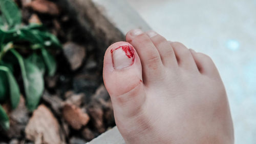 A wound on the toenail