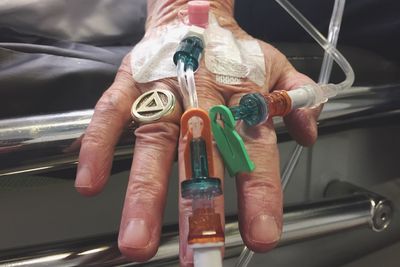 Close-up of hand with iv drip