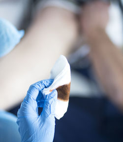 Cropped hand of doctor holding gauze with medicine