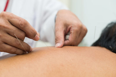 Cropped hands giving acupuncture massage to customer at spa