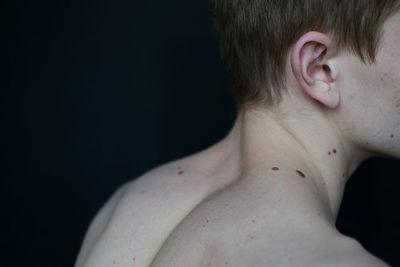 Midsection of shirtless man with wart against black background