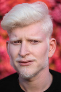 Portrait of an albino man looking in the camera