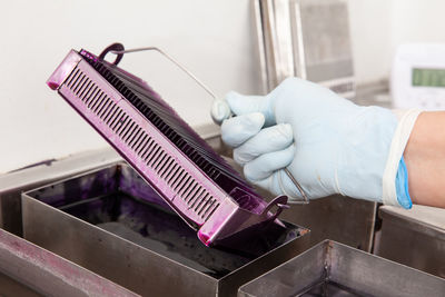 Scientist staining microscope slides for cytology studies in the laboratory.