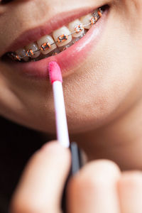 Close-up of young woman with braces applying lipstick