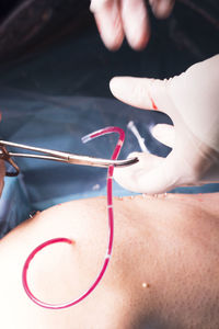 Cropped hands of surgeon cutting pipe while performing surgery