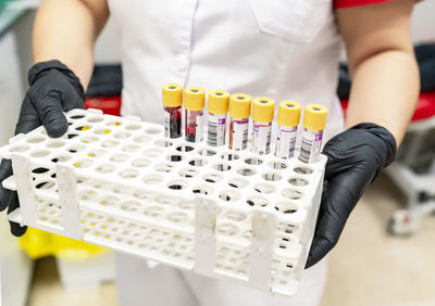 Female doctor handling blood donation test tubes