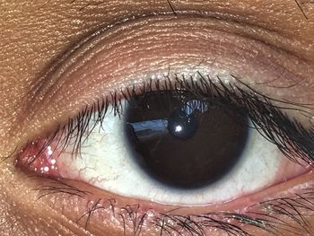 human eye