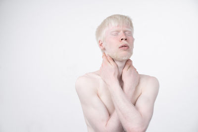 Shirtless young man with albino against white background