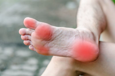 Low section of man with foot pain sitting outdoors