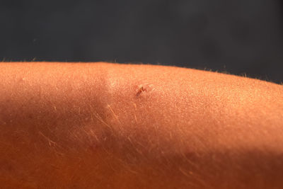 Close-up of fly on a person