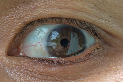 Close-up of human eye