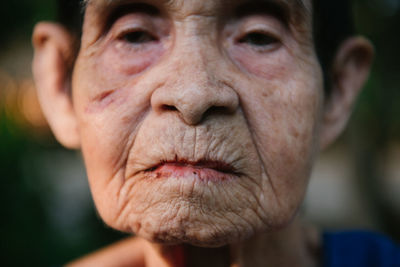 Close-up of woman with scar on cheek