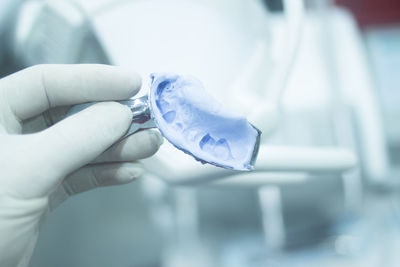 Close-up of hand holding dental mold