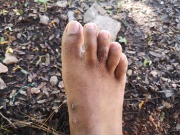 Low section of person legs on field