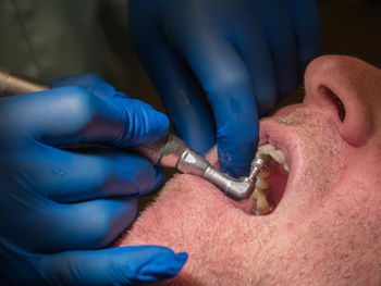 Cropped hands of dentist using equipment on patient